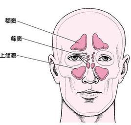 慢性副鼻窦炎(疾病)慢性副鼻窦炎是以鼻塞,流脓鼻涕,头昏,头痛,嗅觉