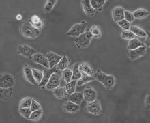 nih3t3 swiss小鼠胚胎成纤维细状(黑白图)