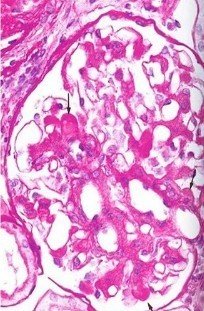 iga是什么肾炎 t011c1c2ac289c29f58.jpg?size=204x311