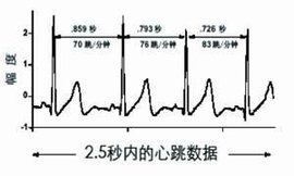 如何正常测量心率变异性 t01c1aaaac0de2b5f11.jpg?size=300x180
