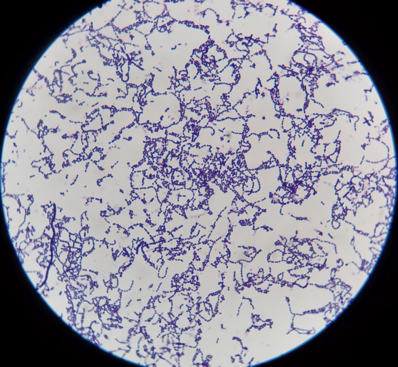 链杆菌显微镜下图片图片