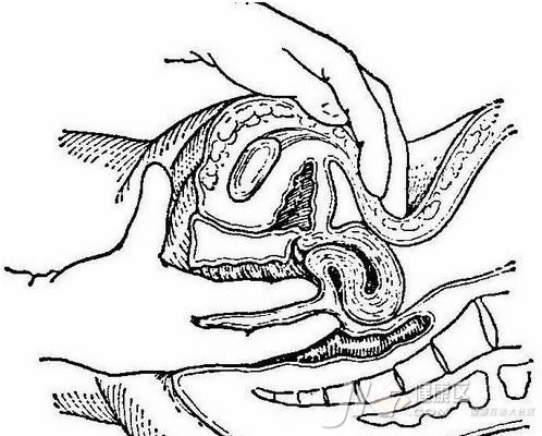 直肠指检(医学名词)直肠指检就是医生用一个手指头伸进患者的肛门,是
