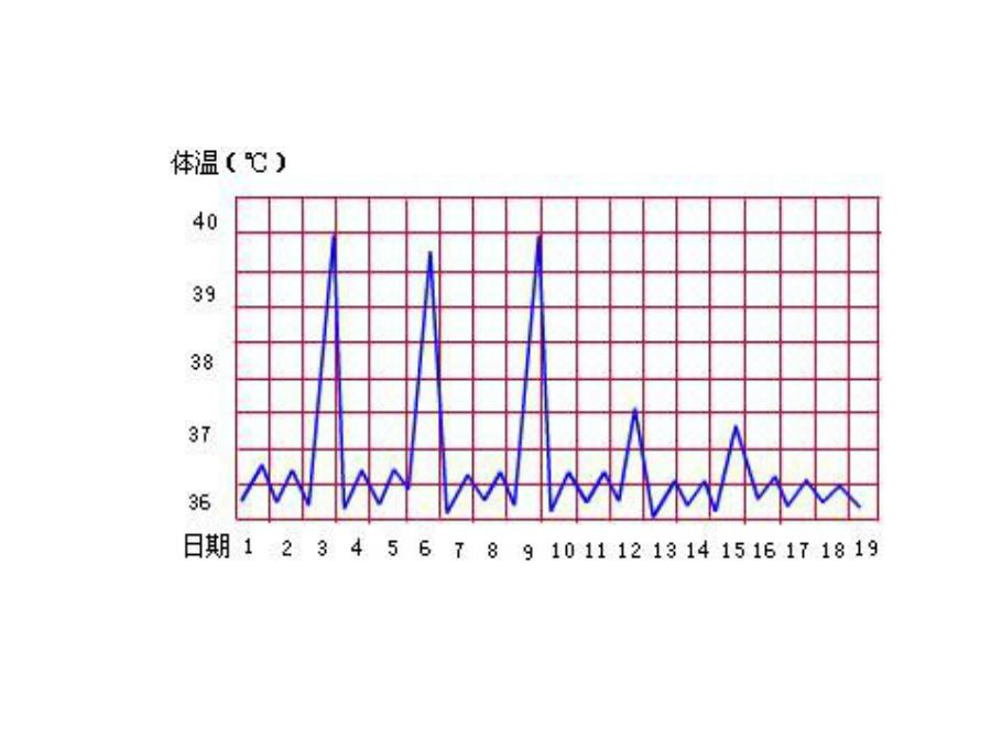 发热热型(凝聚态物理学)发热患者在不同时间测得的