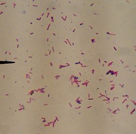 革兰染色(其他生物学相关)革兰染色法,由丹麦病理学家christain gram