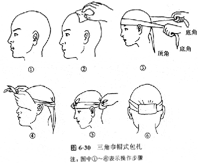 达到压迫止血,减少感染,保护伤口,减少疼痛,以及固定敷料和夹板等目的