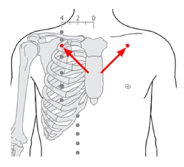 库房穴(中医学与中药学)