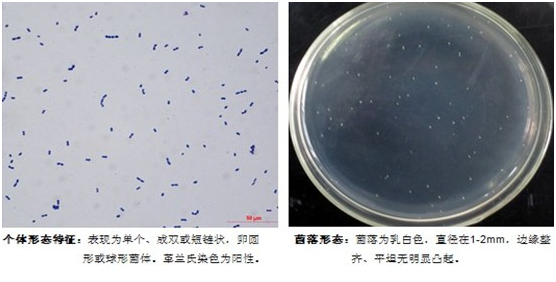 粪肠球菌镜检图片