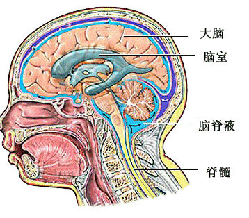 脑梗死位置图图片