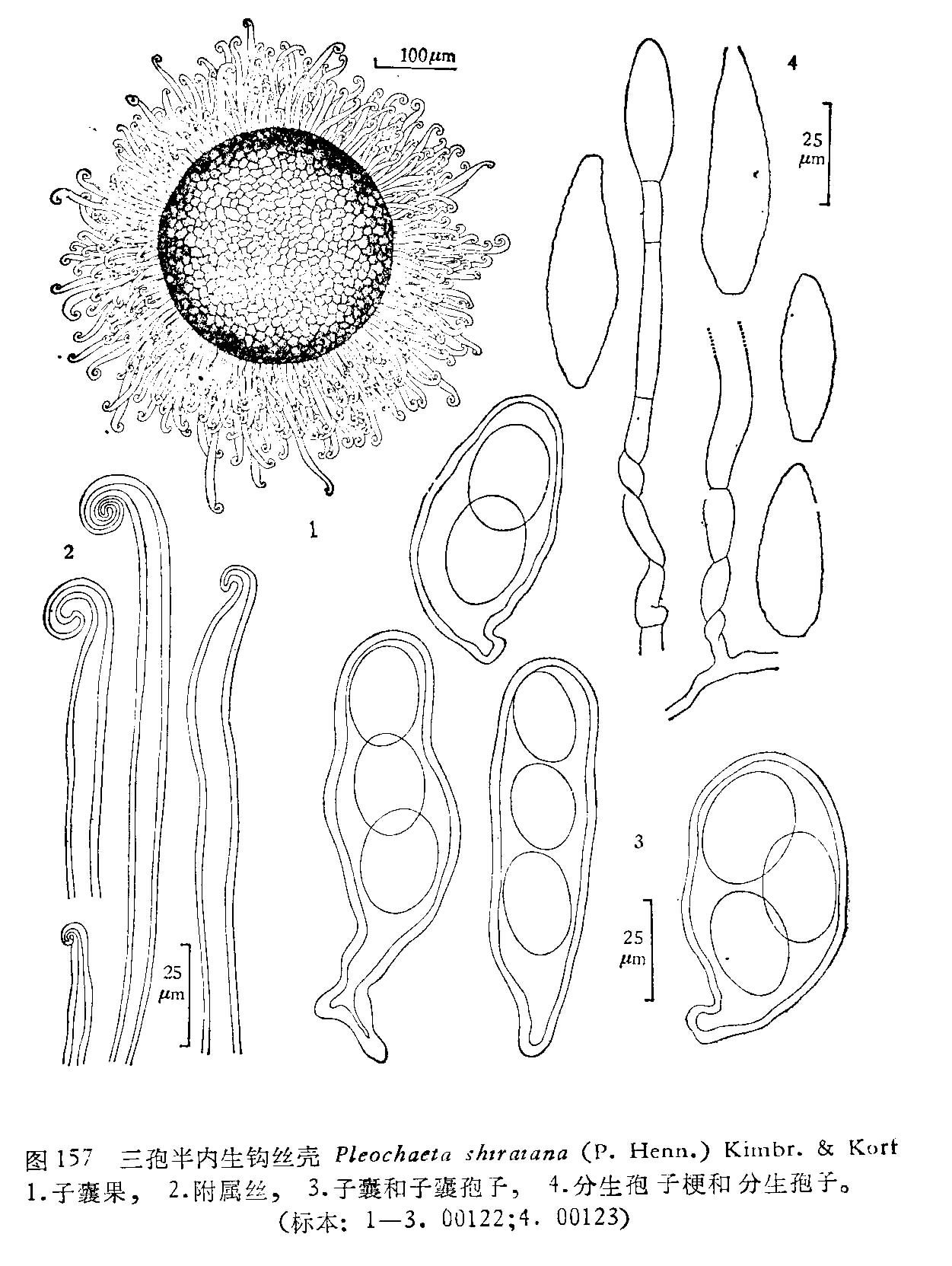 三孢半内生钩丝壳 (其他生物相关)