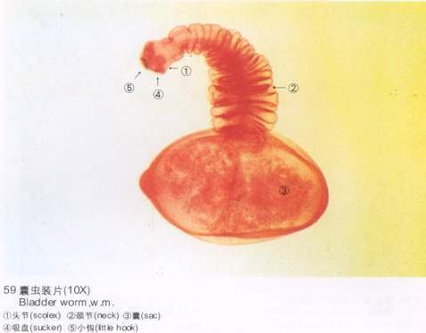 猪囊尾蚴结构图图片