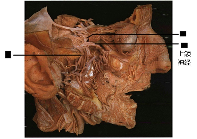 上颌神经(神经生物学)上颌神经:maxillarynerve:经圆孔出颅至翼腭窝