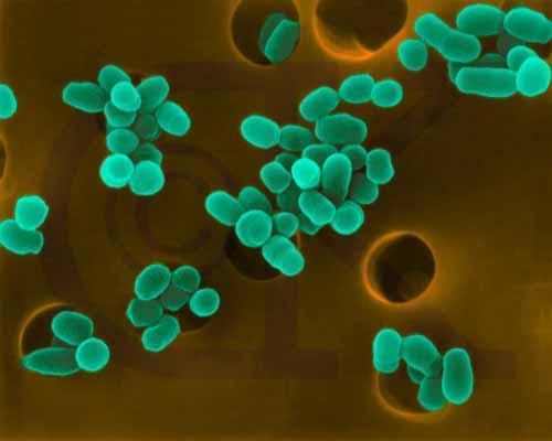 布鲁氏菌其他生物相关