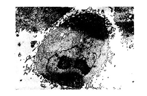 细胞衰老(分子生物学)