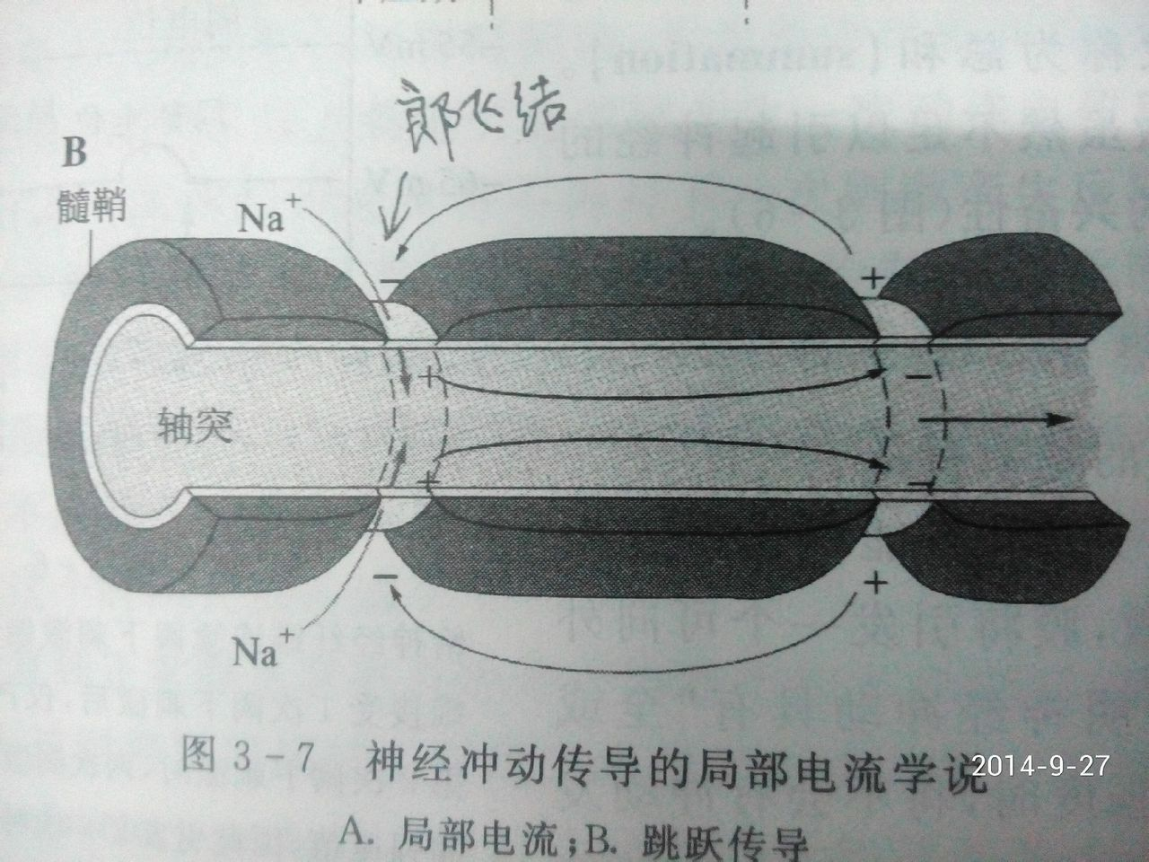 细窄部分称为郎飞结郎飞结郎飞结(英语:nodes of ranvier)又名郎氏结