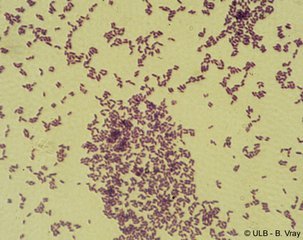 灰色大孢链霉菌(其他生物相关)外形孢子丝紧密短螺旋形,2-3圈,有时达4
