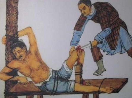膑刑(其他)夏商五刑之一,又称刖刑,是断足或砍去犯人膝盖骨的刑罚