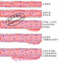 炎症_360百科