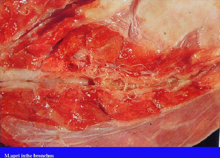 牛肺线虫病 (疾病)
