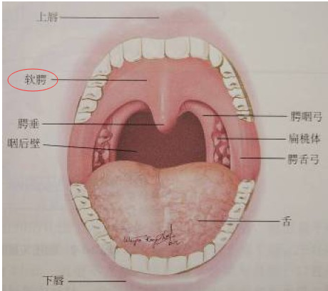 口腔腭垂图片图片