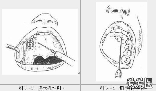 口腔手绘解剖图图片