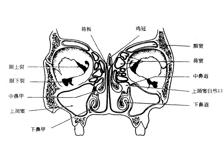 蝶窦额窦筛窦的解剖图图片