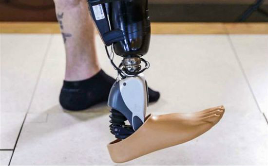 智能仿生腿(科研机构)