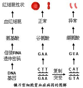 镰刀型细胞贫血症360百科 
