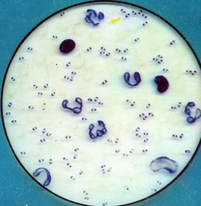 巴氏杆菌科图片