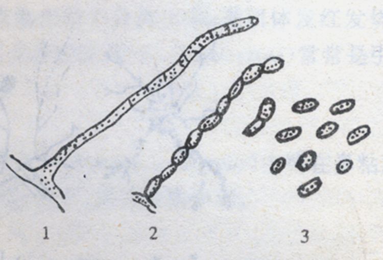 放线菌实验报告图手绘图片