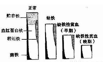 度(医学名词)血清铁饱和度是医学用语,即血清铁与总铁结合力的百分比