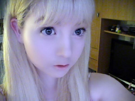 白化病萝莉其他