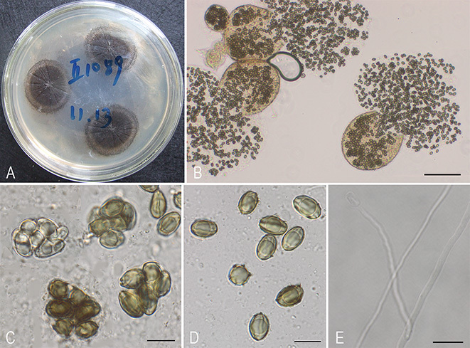 竹基囊孢壳(其他生物相关)