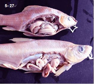 鲫舌形绦虫病 (疾病)