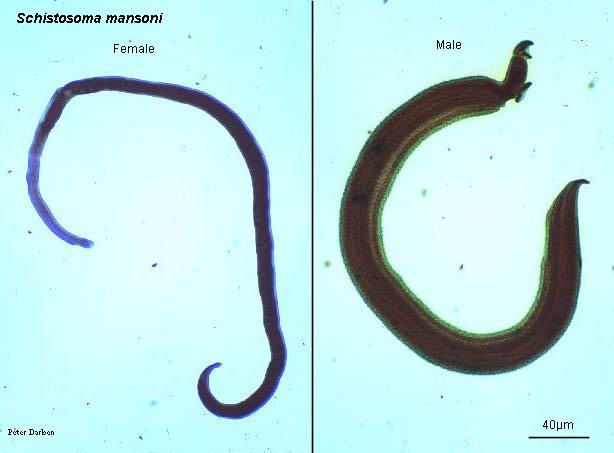 裂体吸虫(schistosoma haematobium, 即埃及血吸虫)生活在膀胱静脉内