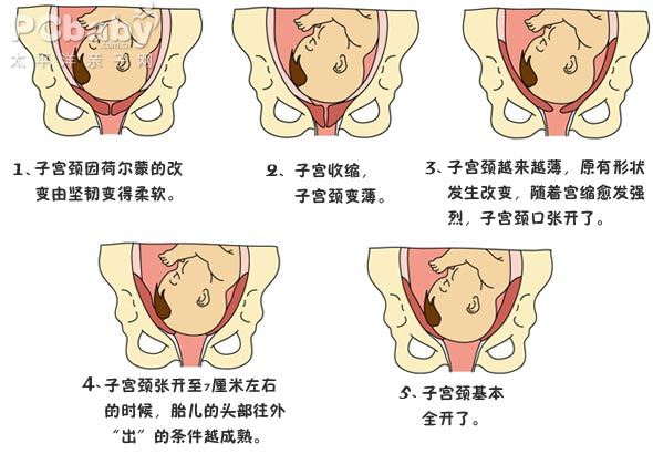 产程图解读ppt图片