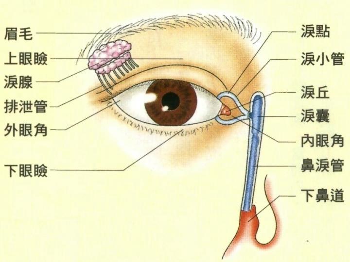 眼挑针(疾病)眼挑针是很常见的眼科病症,是一种 眼皮脂腺的急性化脓