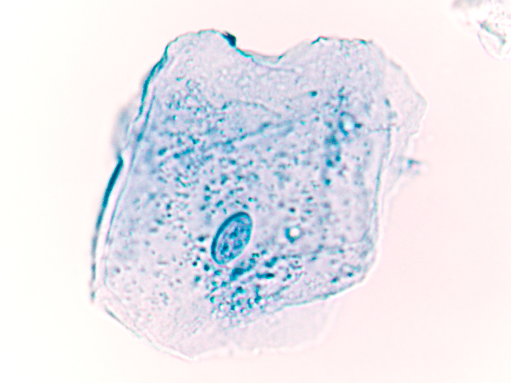 詹纳斯绿(其他化学相关)詹纳斯绿(janus green b),别名:健那绿詹纳斯
