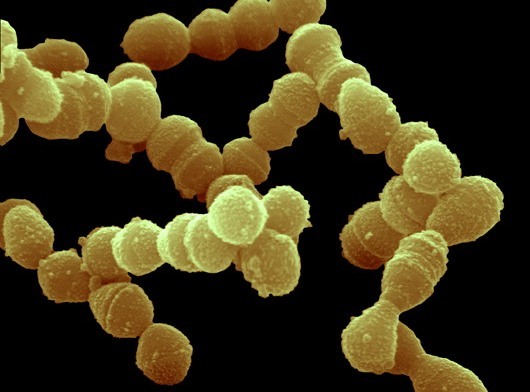 肺炎链球菌肺炎医学名词