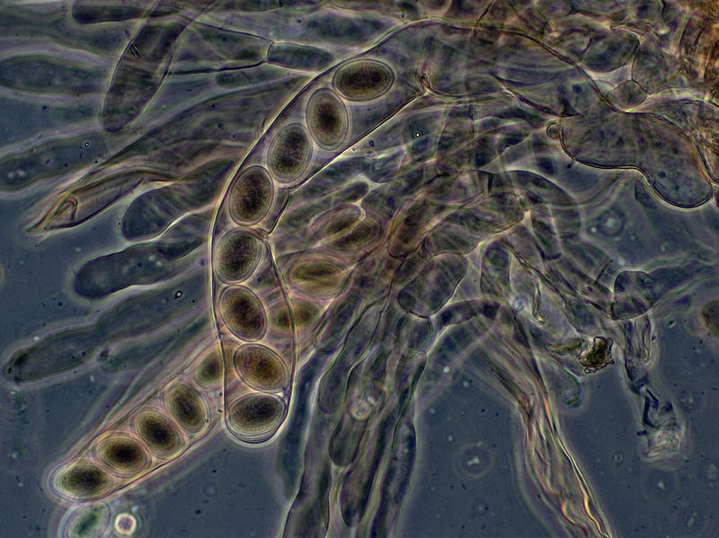 子囊(其他生物相关)是真菌界子囊菌的有性生殖器官