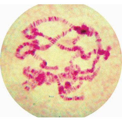 染色体结构变异显微镜图片