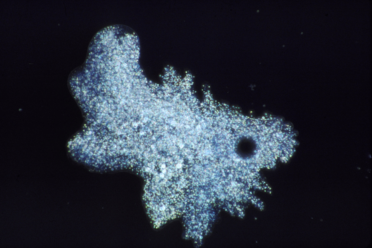 阿米巴 (词条暂无分类)