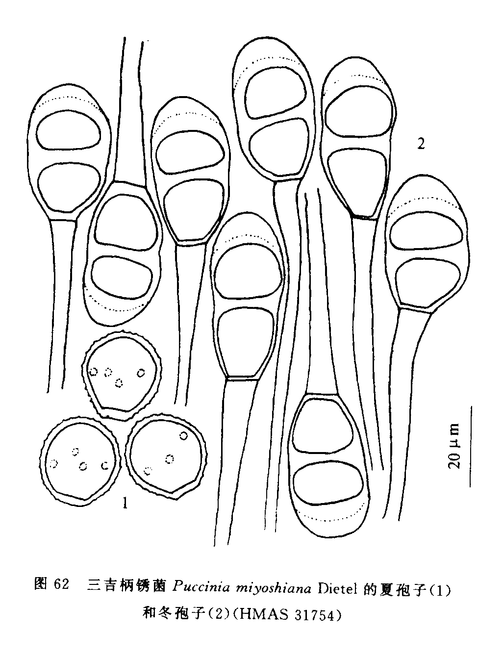 柄锈菌属夏孢子图片