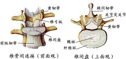 棘间韧带炎位置图图片