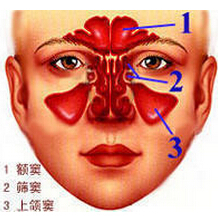 (疾病)鼻疖肿系鼻前庭或鼻尖部的皮脂腺或毛囊的急性局限性化脓性炎症