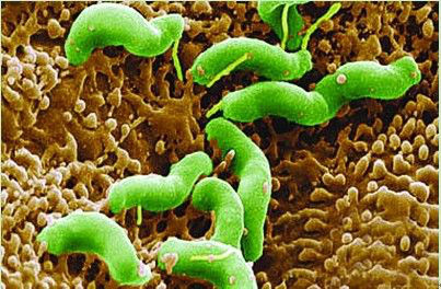 螺杆菌(其他生物相关)自1983年marshall和warren发现了