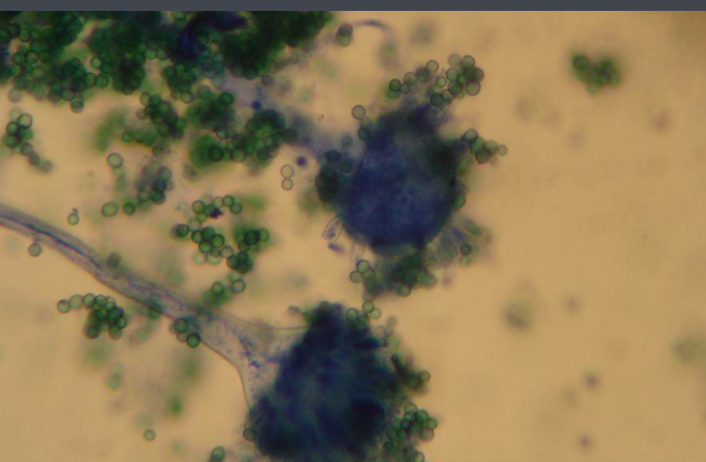 霉菌孢子(其他生物相关)