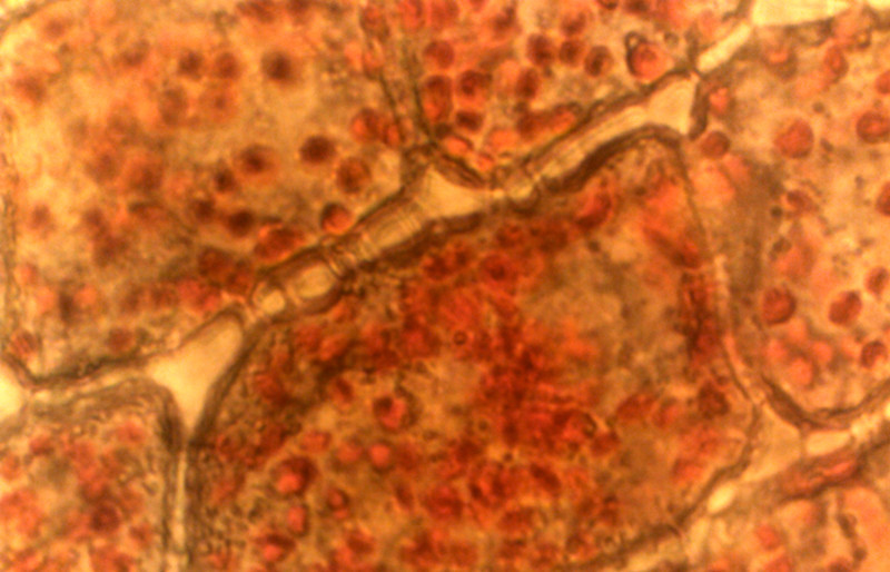 红辣椒胞间连丝显微图图片