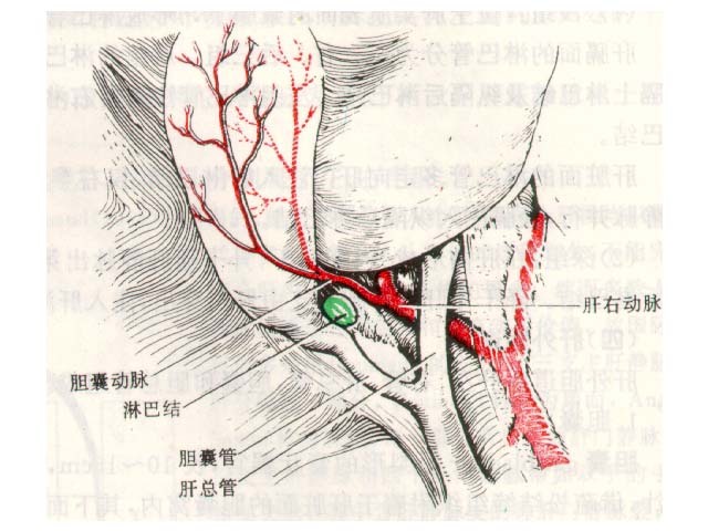 胆囊三角(医学名词)解剖学上将胆囊管,肝总管及肝脏脏面三者构成的