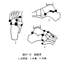 钩骨 部位图片